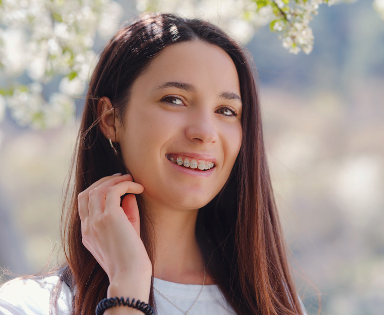 How do fixed braces work? How do fixed braces work?